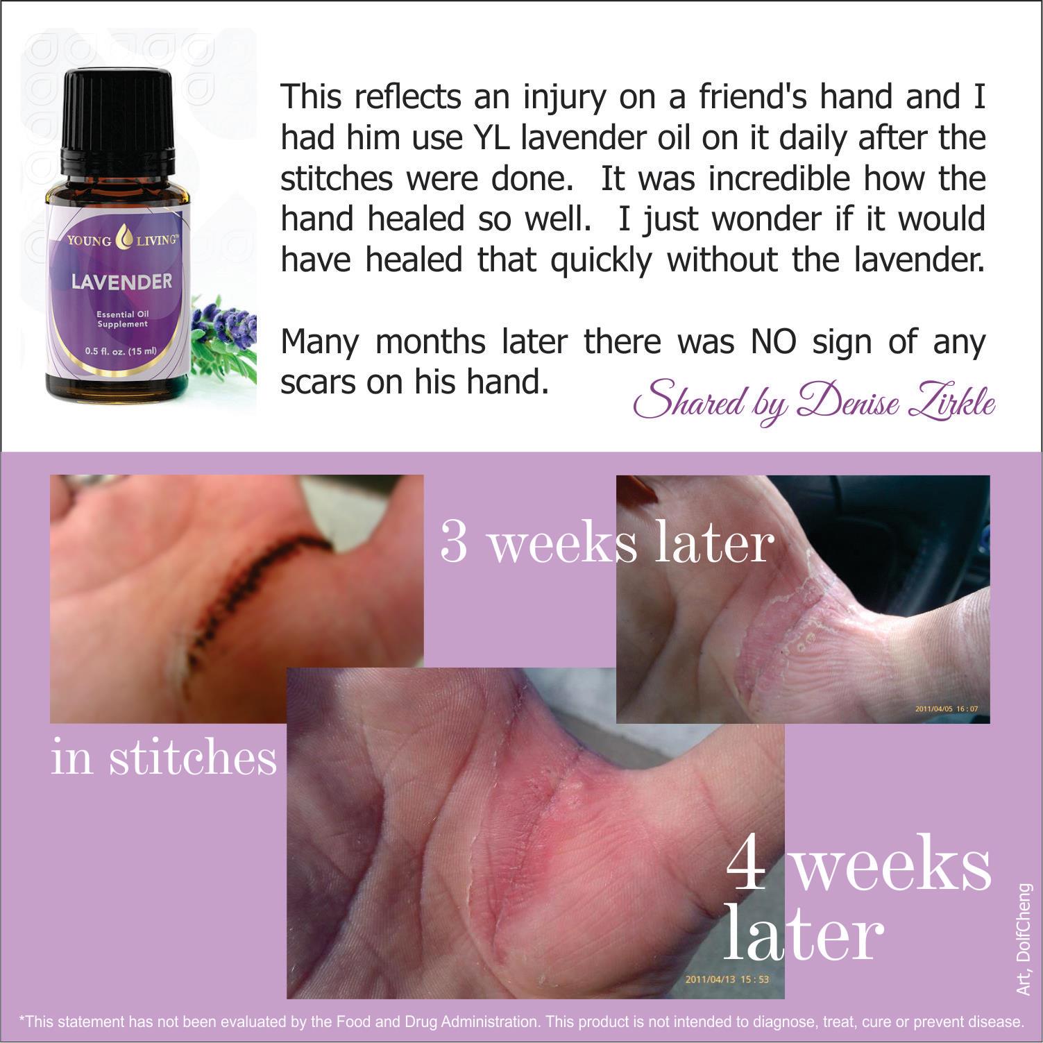 8 Incredible Uses Of Lavender Oil World inside pictures